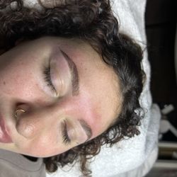 Elevated Skin Esteem