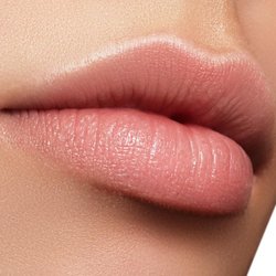 Jolie Visage Medspa & Clinic - lip fillers, botox, dysport, fillers, beautiful lips
