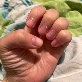 Nail Spa Expose - Bad manicure left side - Nail Salons Near Me - Webster, Texas