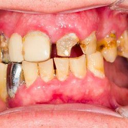 Modern Dentistry