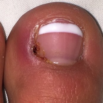Studio Nails - Not worth it at all. Pain has been uncontrollable for 3 days. - Nail Salons Near Me - Panorama City, California Studio Nails - Not worth it at all. Pain has been uncontrollable for 3 days. - Nail Salons Near Me - Panorama City, California