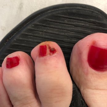 Ocean Isle Nails - I got home and cleaned it up. It continued to bleed. Notice the bad polish on my too short toenail. Geez - Nail Salons Near Me - Ocean Isle Beach, North Carolina Ocean Isle Nails - I got home and cleaned it up. It continued to bleed. Notice the bad polish on my too short toenail. Geez - Nail Salons Near Me - Ocean Isle Beach, North Carolina