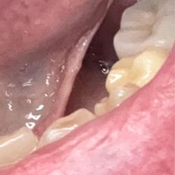 Louis Pannullo DDS MS - His testament to nothings in or around my teeth