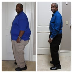 Soza Weight Loss - Covington