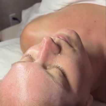Archway Aesthetics - During the facial - Medical Spas Near Me - Las Vegas, Nevada