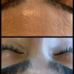 before & after!! before & after!!