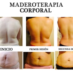 Maderoterapia Mexicali