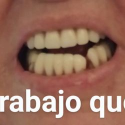 Quincy Dental - I would not recommend that dentist TRABAJO MAL REALIZADO POR LA DRA  DONDE NO RECONOCE SU MAL TRABAJO NO QUIERE ARREGLAR ,