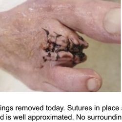 Wyoming Valley Foot Associates
