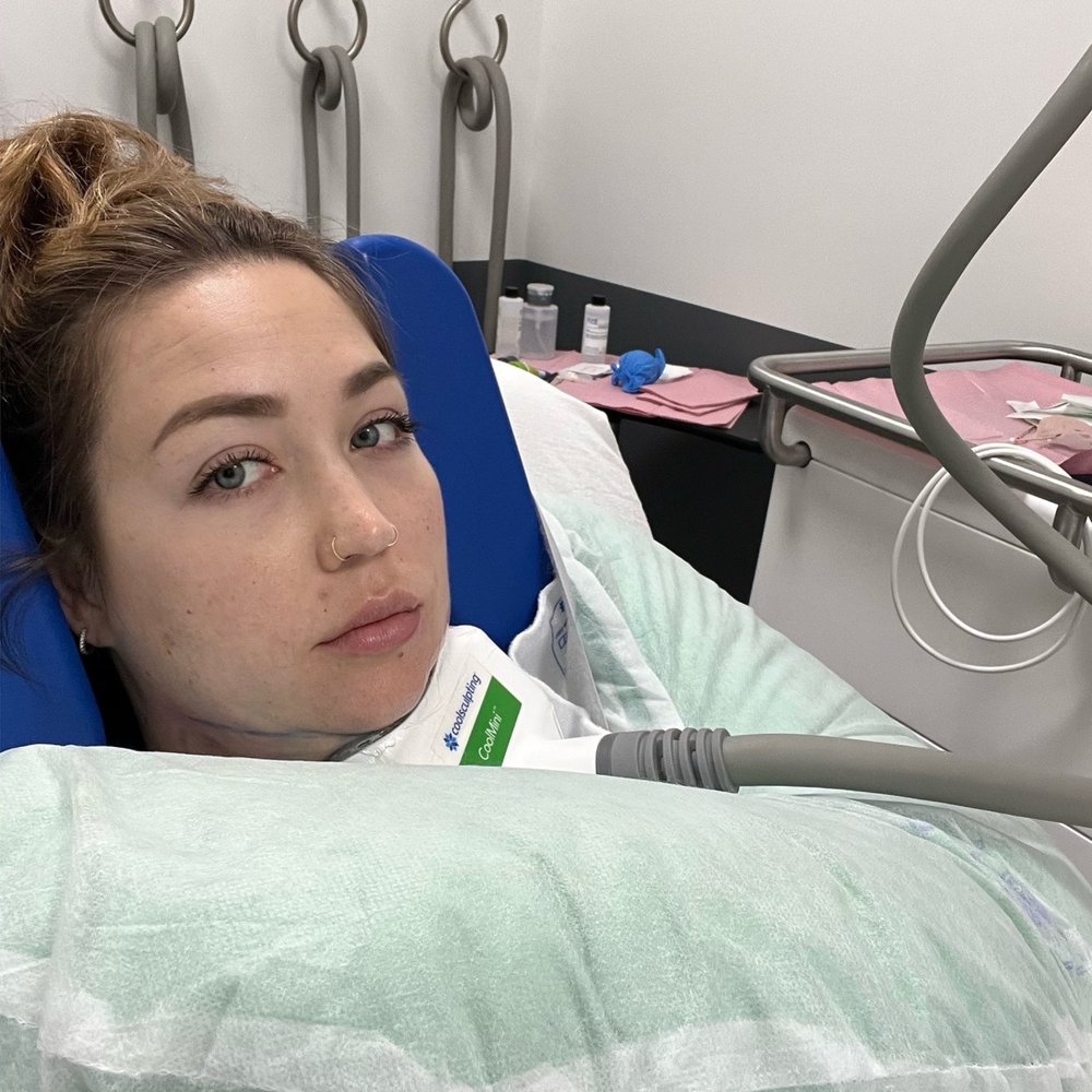 LaserAway - Cool Sculpt mini :D - Medical Spas Near Me - Rancho Cucamonga, California LaserAway - Cool Sculpt mini :D - Medical Spas Near Me - Rancho Cucamonga, California