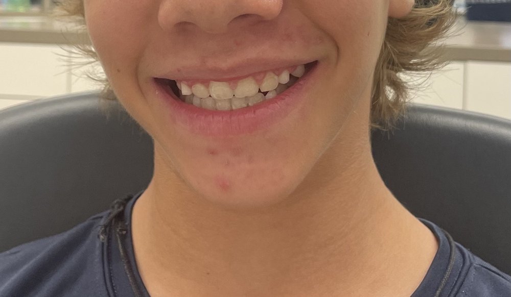 BLACKBURN FAMILY ORTHODONTICS Updated August 2024 16 Photos & 10