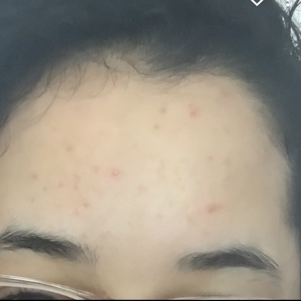 Elevated Aesthetics - Day Spas Near Me - Yonkers, New York Elevated Aesthetics - Day Spas Near Me - Yonkers, New York