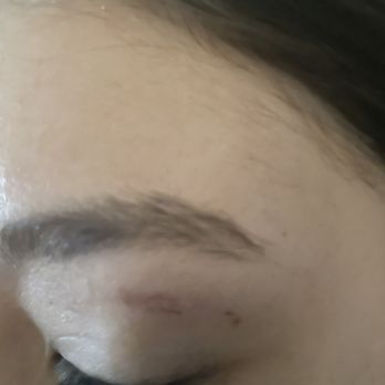 European Wax Center - My daughters eye three days after waxing. Ouch. - Skin Care Near Me - Katy, Texas