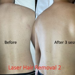 Baliga Ayurveda & Laser Skin Clinic - Men's Laser Hair Removal, London