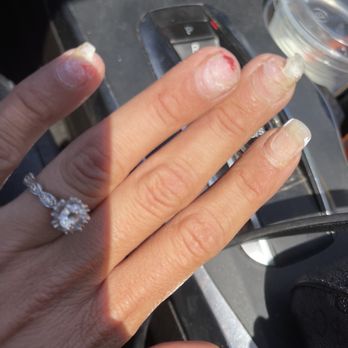 D&B NAIL SPA - Nails gone wrong - Nail Salons Near Me - Anderson, California