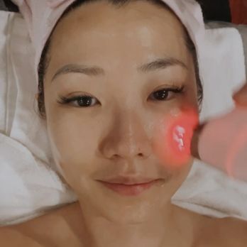 Hills Med Spa - Getting my routine facial~ the best time!! - Medical Spas Near Me - Los Angeles, California Hills Med Spa - Getting my routine facial~ the best time!! - Medical Spas Near Me - Los Angeles, California