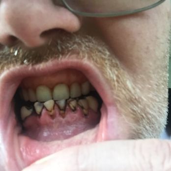 Columbia Basin Denture Care - General Dentistry Near Me - Kennewick, Washington Columbia Basin Denture Care - General Dentistry Near Me - Kennewick, Washington