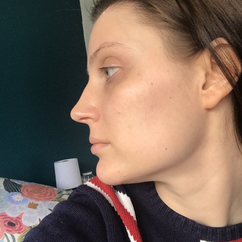 Apostrophe - Acne Dermatologist - Dermatologists Near Me - Oakland, California