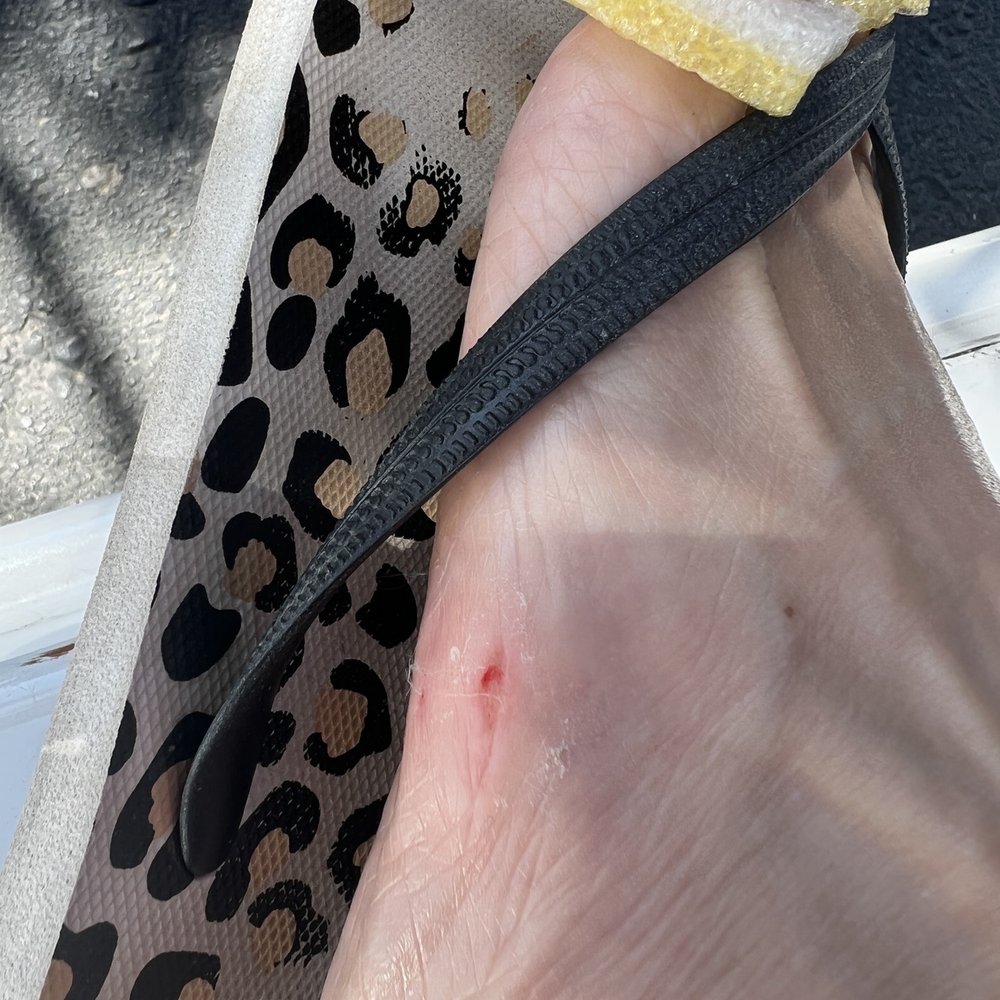Pinky Nails & Spa By Cindy - Grated the skin off my foot - Nail Salons Near Me - Avondale, Arizona Pinky Nails & Spa By Cindy - Grated the skin off my foot - Nail Salons Near Me - Avondale, Arizona
