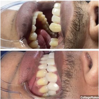 Lady 6 Beauty Bar - Teeth Whitening Near Me - Hazel Park, Michigan Lady 6 Beauty Bar - Teeth Whitening Near Me - Hazel Park, Michigan