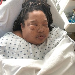 Both my lungs was punctured. Spent a week in ICU. I am still suffering from hunger pains. Both my lungs was punctured. Spent a week in ICU. I am still suffering from hunger pains.