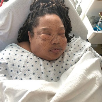 IBI Healthcare - Both my lungs was punctured. Spent a week in ICU. I am still suffering from hunger pains. - Surgeons Near Me - Loganville, Georgia IBI Healthcare - Both my lungs was punctured. Spent a week in ICU. I am still suffering from hunger pains. - Surgeons Near Me - Loganville, Georgia