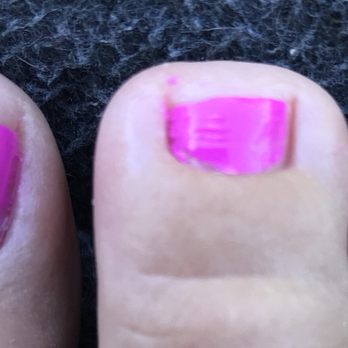 Martell Nails & Spa - Crooked. Paint on skin. Nail not even completely covered. Gloppy paint job. - Nail Salons Near Me - Jackson, California Martell Nails & Spa - Crooked. Paint on skin. Nail not even completely covered. Gloppy paint job. - Nail Salons Near Me - Jackson, California