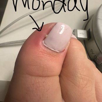 Le Nails Spa - Monday night right toe, pus coming out after soaking - Nail Salons Near Me - Vacaville, California