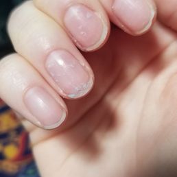 My ring. Middle. And pointer all got the fix but I can't seem to get the glue off my ring finger from that fix! My ring. Middle. And pointer all got the fix but I can't seem to get the glue off my ring finger from that fix!