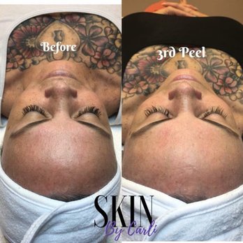 SKIN By Carli - Skin Care Near Me - Huntington Beach, California SKIN By Carli - Skin Care Near Me - Huntington Beach, California