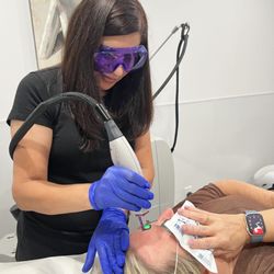 NU Med Spa - RN Abida diminishing facial redness with our VBeam Laserr