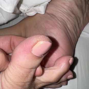 Golden Nails - More dry skin - Nail Salons Near Me - Castro Valley, California