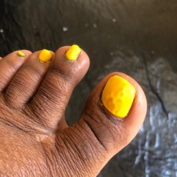 Big toe gel nightmare Big toe gel nightmare