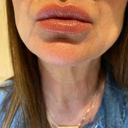 Lips! Lips!
