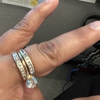 Joe the Jeweler - Ring new prongs, other side view - Jewelry Repair Near Me Joe the Jeweler - Ring new prongs, other side view - Jewelry Repair Near Me