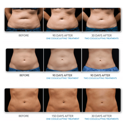 Aesthetic Laser Care