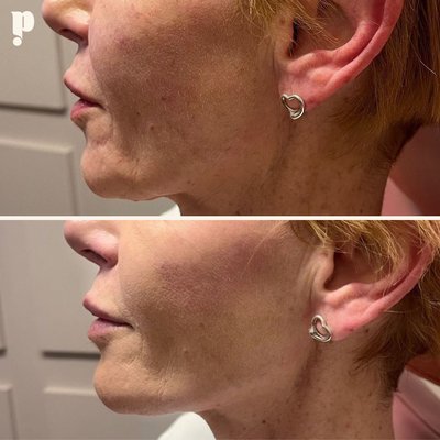 Plump 2024 - Plump Cosmetics & Injectables Plump 2024 - Plump Cosmetics & Injectables