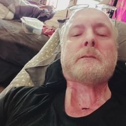 Fairview Health Services - This is me. I am in horrible pain.