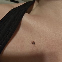 Chenoa Tattoo Company - Dermal sinking into skin