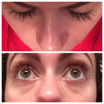 Lolly Beauty - A week later - the lashes are scarce and hardly noticeable - Permanent Makeup Near Me - San Jose, California Lolly Beauty - A week later - the lashes are scarce and hardly noticeable - Permanent Makeup Near Me - San Jose, California