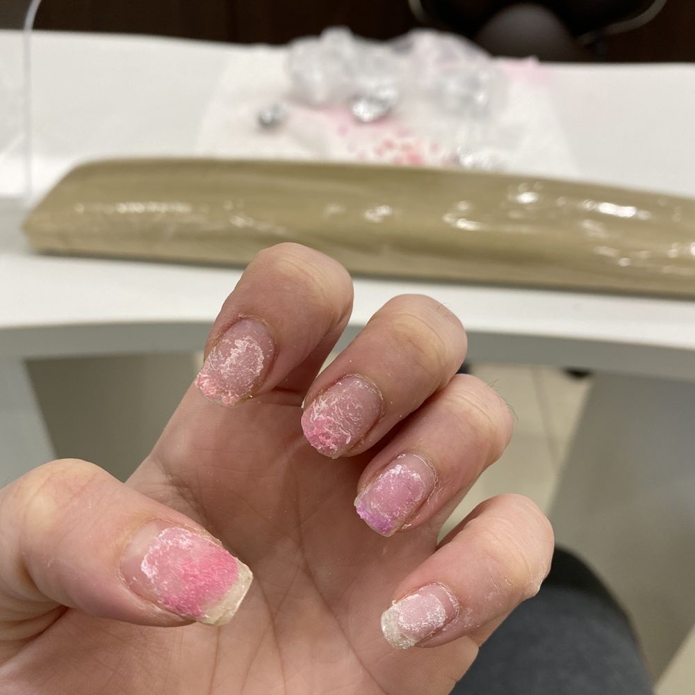 Vida Nails & Spa - This is after I removed my last set myself - Nail Salons Near Me - Warwick, Rhode Island Vida Nails & Spa - This is after I removed my last set myself - Nail Salons Near Me - Warwick, Rhode Island