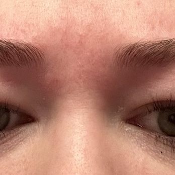 Beautiful You - My eyes the day after my appointment with Ann at Beautiful You- painful allergic reaction, could barely open my eyes - Eyelash Service Near Me - San Jose, California