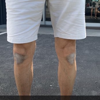 SecurCare Self Storage - My husbands knee after kneeling for 30 second in the hall outside our storage unit. - Self Storage Near Me - Charleston, South Carolina