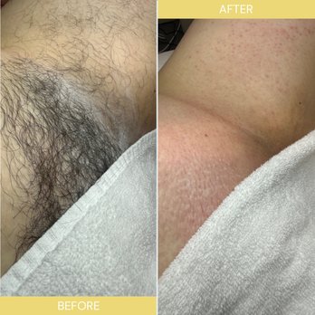 Luna Sugar - Brazilian sugaring - Sugaring Near Me - Huntington Beach, California Luna Sugar - Brazilian sugaring - Sugaring Near Me - Huntington Beach, California