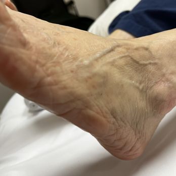 Health Matters - Plantar fasciitis - Reflexology Near Me - Hamilton, Ontario Health Matters - Plantar fasciitis - Reflexology Near Me - Hamilton, Ontario