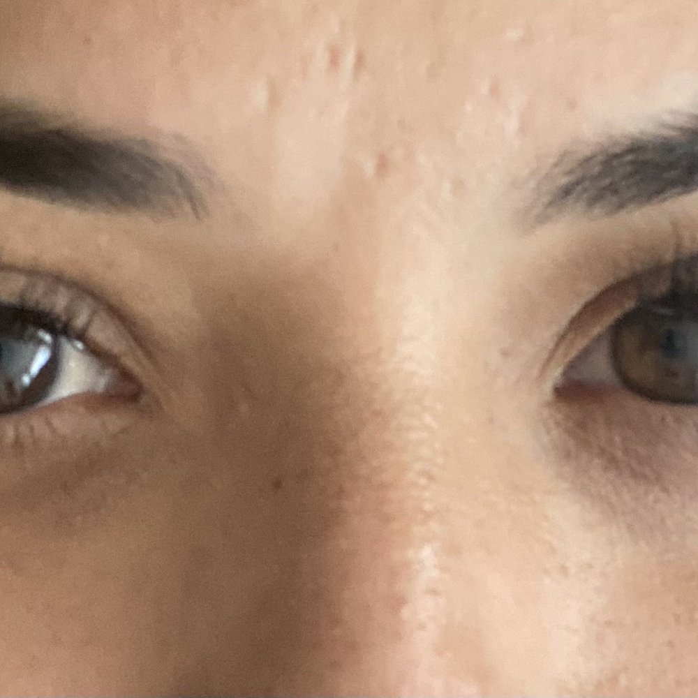 Amazing Lash Studio - Phoenix Eyelash Extensions - "Classic lashes " You can see in the picture my right eye isn't as smooth/full looking and the lashes are shorter. - Eyelash Service Near Me - Phoenix, Arizona Amazing Lash Studio - Phoenix Eyelash Extensions - "Classic lashes " You can see in the picture my right eye isn't as smooth/full looking and the lashes are shorter. - Eyelash Service Near Me - Phoenix, Arizona