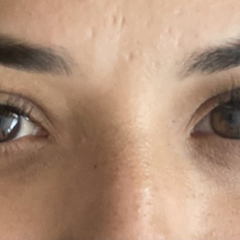 Amazing Lash Studio - Phoenix Eyelash Extensions - "Classic lashes " You can see in the picture my right eye isn't as smooth/full looking and the lashes are shorter. - Eyelash Service Near Me - Phoenix, Arizona Amazing Lash Studio - Phoenix Eyelash Extensions - "Classic lashes " You can see in the picture my right eye isn't as smooth/full looking and the lashes are shorter. - Eyelash Service Near Me - Phoenix, Arizona