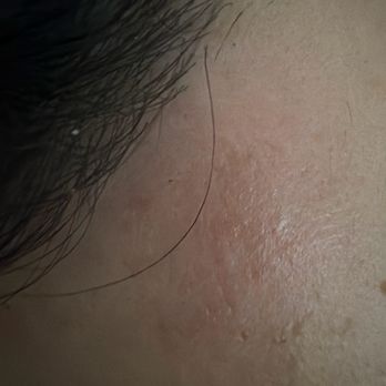 Grace Threading - skin damage from side wax - Skin Care Near Me - San Diego, California