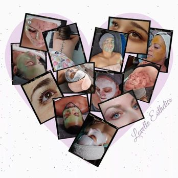 Lovelle Esthetics - Lovelle treatment photo collage - Skin Care Near Me - Niagara Falls, New York