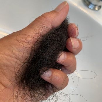 ONE40 Beauty Lounge - HAIR LOSS - Skin Care Near Me - Henderson, Nevada ONE40 Beauty Lounge - HAIR LOSS - Skin Care Near Me - Henderson, Nevada